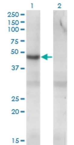 Monoclonal Anti-PIP5K2C antibody produced in mouse