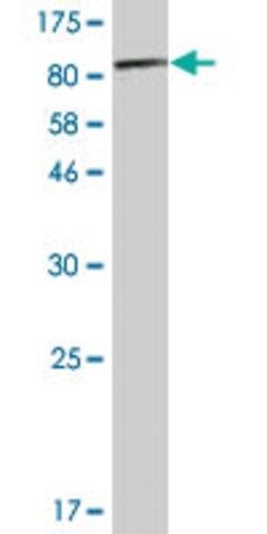 Monoclonal Anti-PKM2 antibody produced in mouse