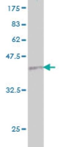 Monoclonal Anti-PLG antibody produced in mouse