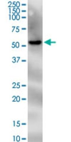 Monoclonal Anti-PNPLA2 antibody produced in mouse