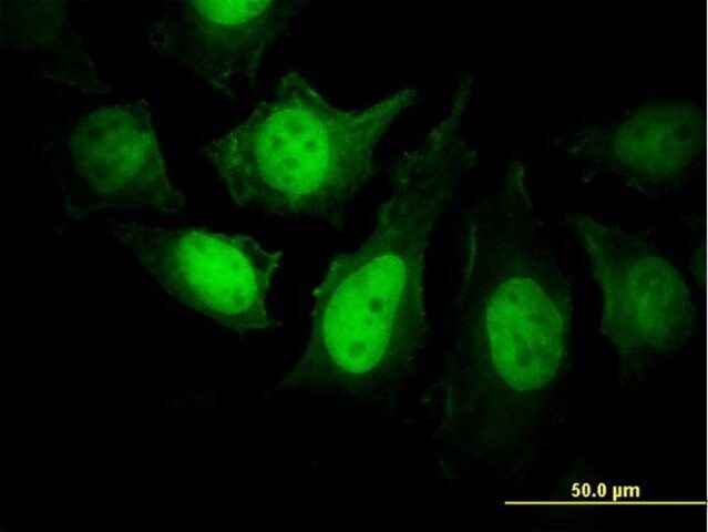 Monoclonal Anti-PPP3R1 antibody produced in mouse