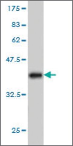 Monoclonal Anti-PPP1R9A antibody produced in mouse