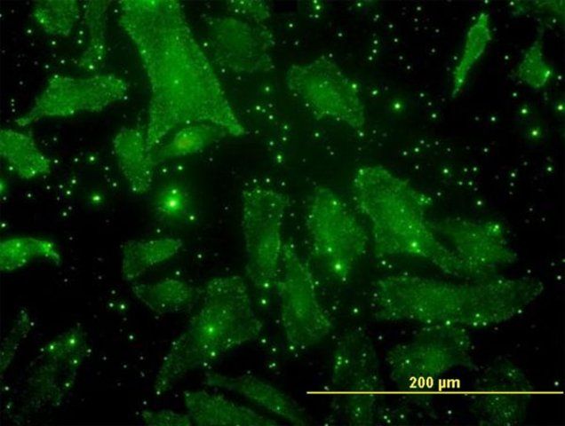 Monoclonal Anti-BGLAP antibody produced in mouse