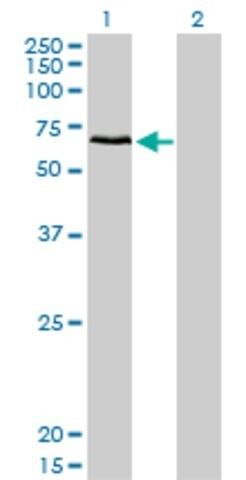 Monoclonal Anti-CACNB1 antibody produced in mouse