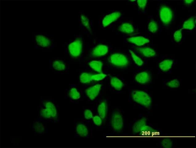 Monoclonal Anti-CAMK2A antibody produced in mouse