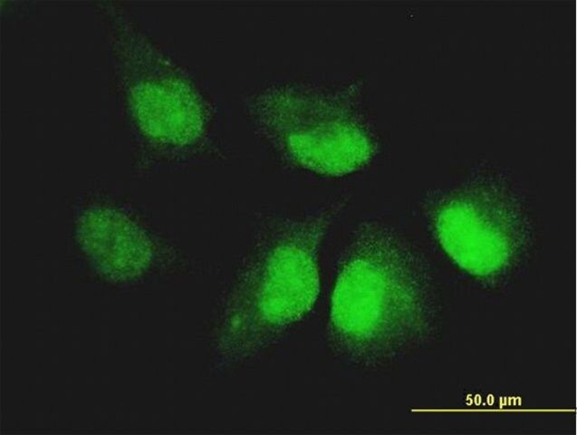 Monoclonal Anti-CASP14 antibody produced in mouse