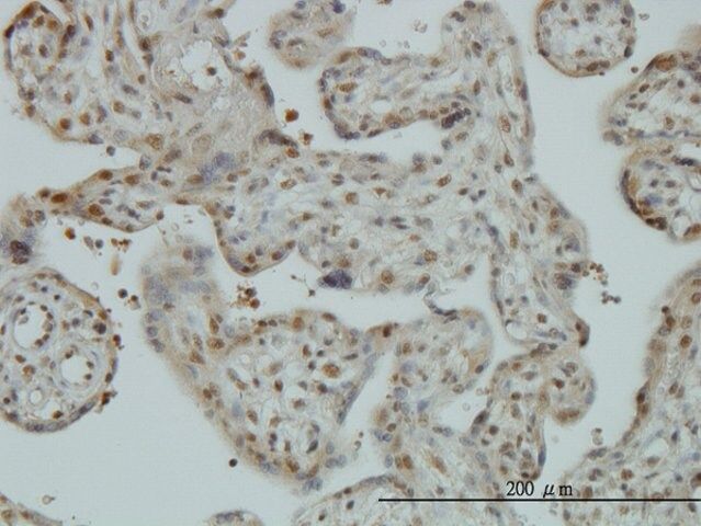 Monoclonal Anti-CAND1 antibody produced in mouse