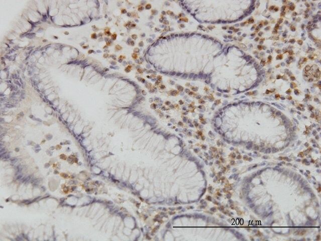 Monoclonal Anti-CAMKK1 antibody produced in mouse