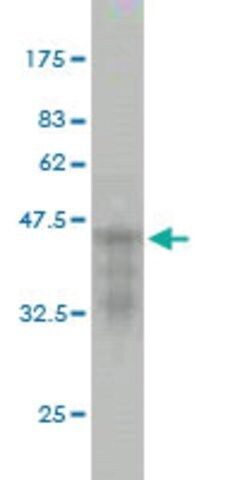 Monoclonal Anti-CDKL5 antibody produced in mouse