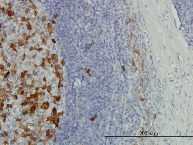 Monoclonal Anti-TYMS antibody produced in mouse