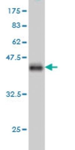 Monoclonal Anti-UCHL3 antibody produced in mouse