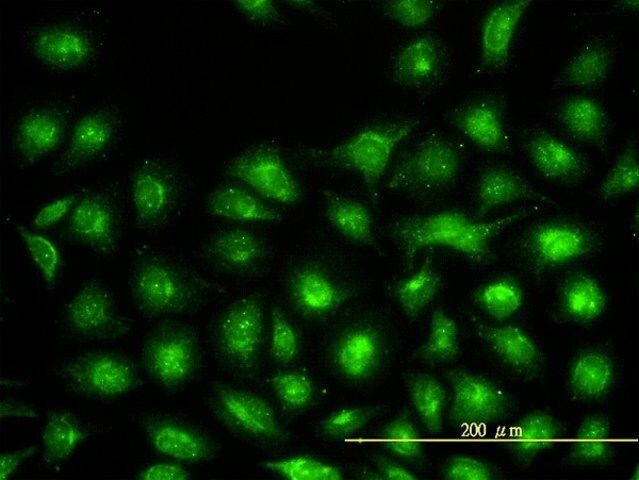 Monoclonal Anti-UBE2L3 antibody produced in mouse