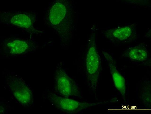 Monoclonal Anti-ZNF181 antibody produced in mouse