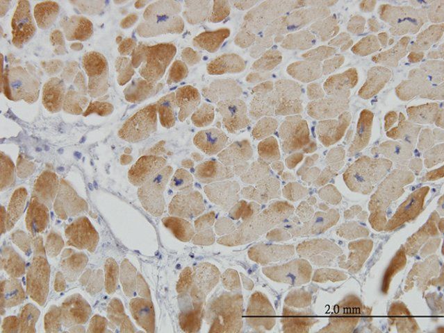 Monoclonal Anti-ACADVL antibody produced in mouse