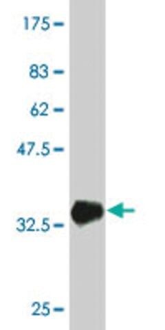 Monoclonal Anti-ABCA10 antibody produced in mouse