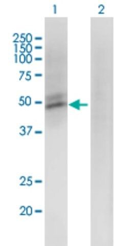 Monoclonal Anti-ACMSD antibody produced in mouse