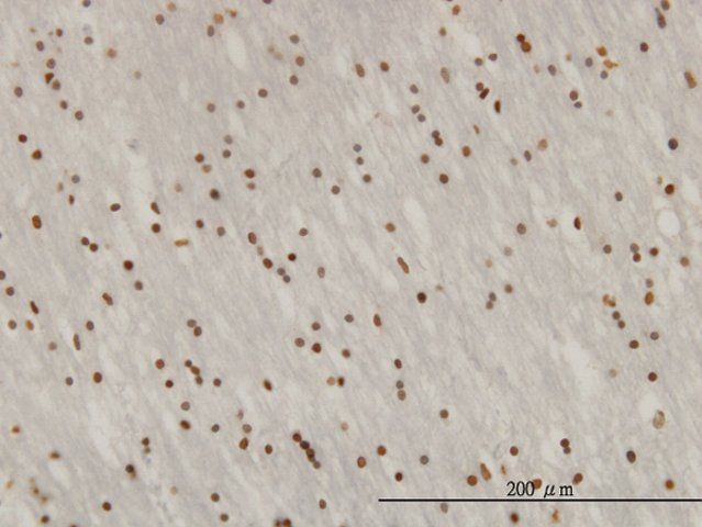 Monoclonal Anti-ZNF313 antibody produced in mouse