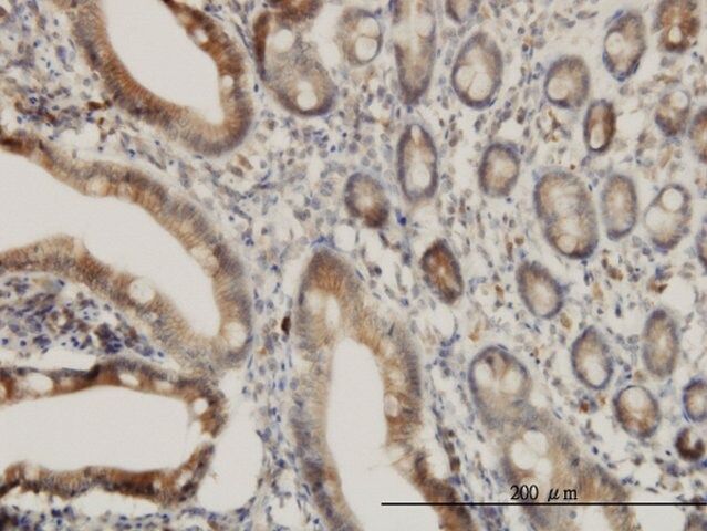 Monoclonal Anti-ADAM17 antibody produced in mouse