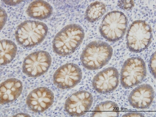 Monoclonal Anti-ACSL5 antibody produced in mouse