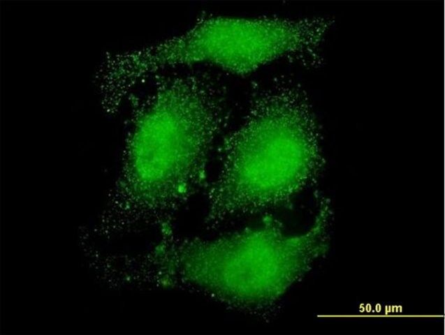 Monoclonal Anti-ATN1 antibody produced in mouse