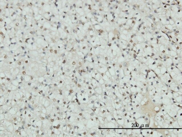 Monoclonal Anti-AR antibody produced in mouse