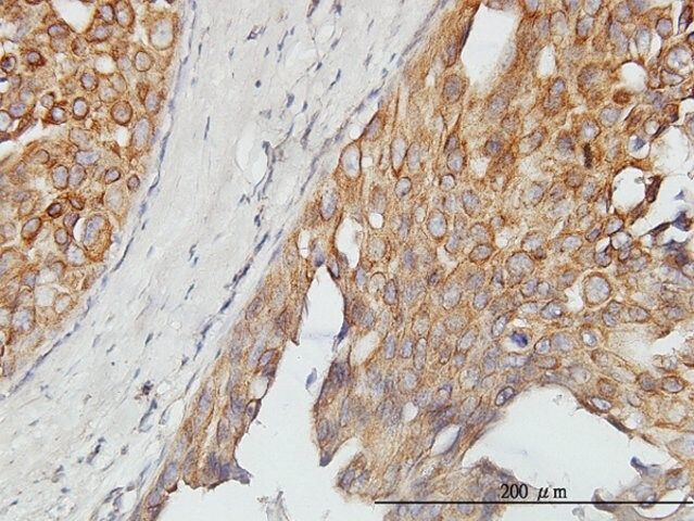 Monoclonal Anti-ASPSCR1 antibody produced in mouse