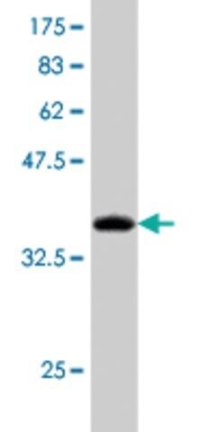 Monoclonal Anti-AUH antibody produced in mouse