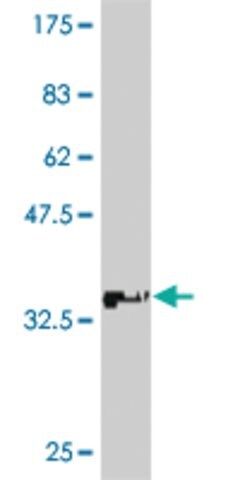 Monoclonal Anti-ATP7B antibody produced in mouse