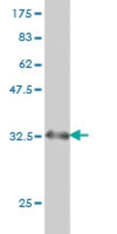 Monoclonal Anti-BDKRB2 antibody produced in mouse