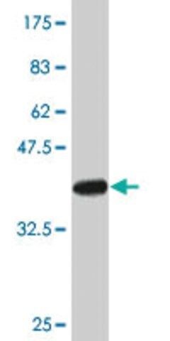 Monoclonal Anti-BCAP31 antibody produced in mouse