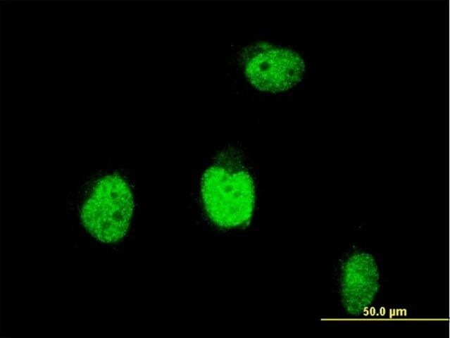 Monoclonal Anti-BLM antibody produced in mouse