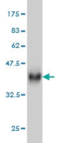 Monoclonal Anti-RPS27A antibody produced in mouse