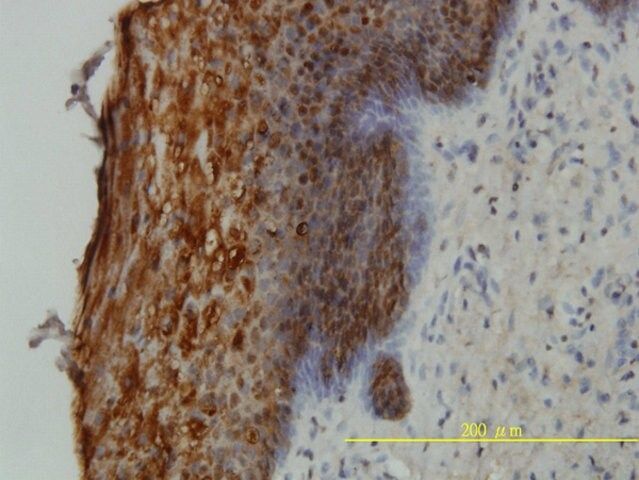 Monoclonal Anti-SFN antibody produced in mouse