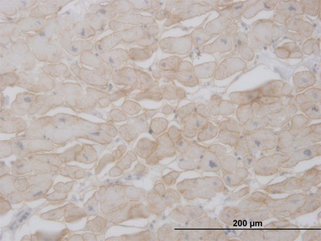 Monoclonal Anti-SGCB antibody produced in mouse