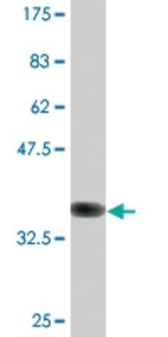 Monoclonal Anti-DIRAS3 antibody produced in mouse