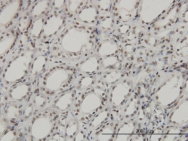 Monoclonal Anti-SGK antibody produced in mouse