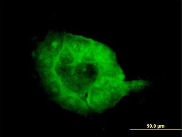 Monoclonal Anti-SH3BP2 antibody produced in mouse