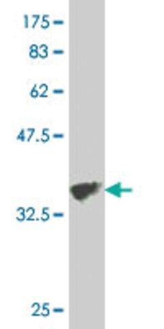 Monoclonal Anti-COL5A3 antibody produced in mouse