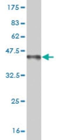 Monoclonal Anti-FOXP1 antibody produced in mouse