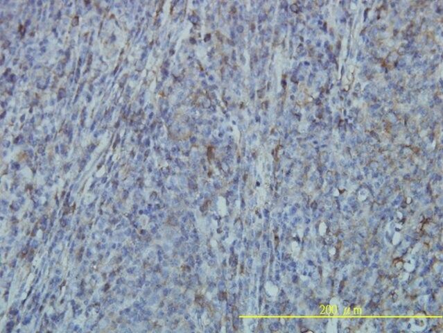 Monoclonal Anti-FLNA antibody produced in mouse