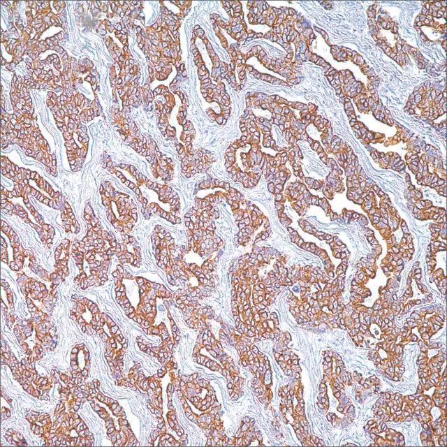 Cytokeratin Cocktail (AE1 &AE3) Mouse Monoclonal Antibody