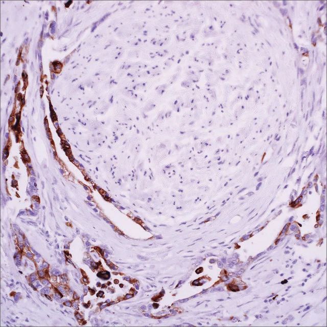 MUC4 (8G7) Mouse Monoclonal Antibody