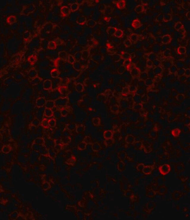 Anti-Rabbit IgG (whole molecule)CTRITC antibody produced in goat