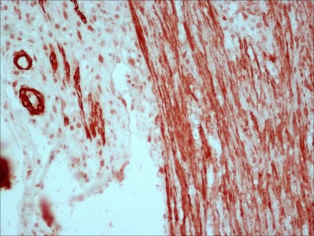 Anti-Mouse IgG (Fc specific)CPeroxidase antibody produced in goat