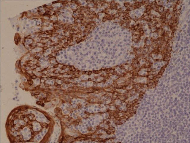 Anti-CK-5/CK-6 (Cytokeratin 5/ Cytokeratin 6) antibody, Rabbit monoclonal