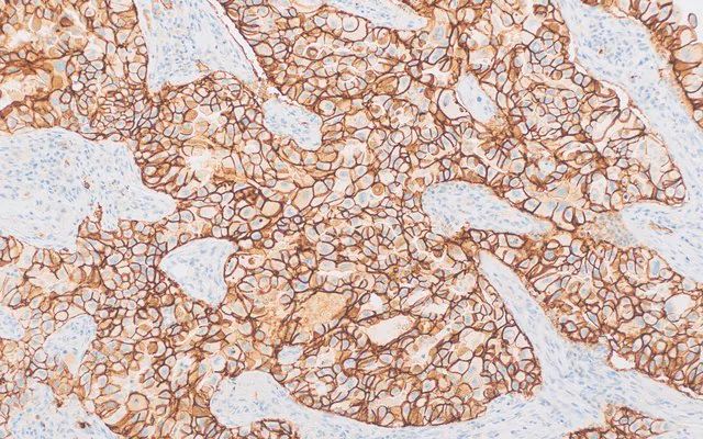 Claudin-4 (EP417) Rabbit Monoclonal Primary Antibody