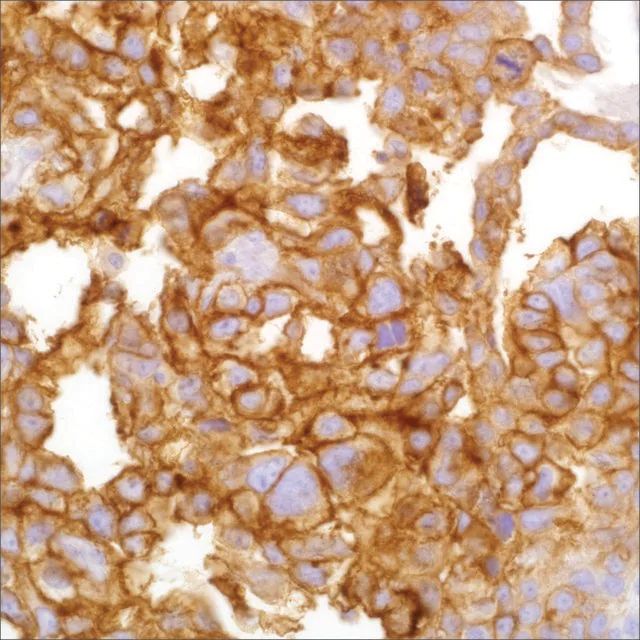 GLUT3 Rabbit Polyclonal Antibody