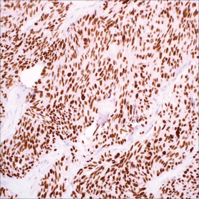 Islet-1 (EP283) Rabbit Monoclonal Primary Antibody