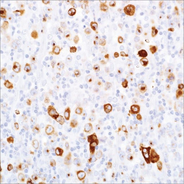 Granzyme B Rabbit Polyclonal Antibody