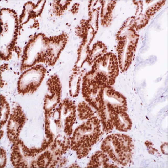 ERG (EP111) Rabbit Monoclonal Primary Antibody